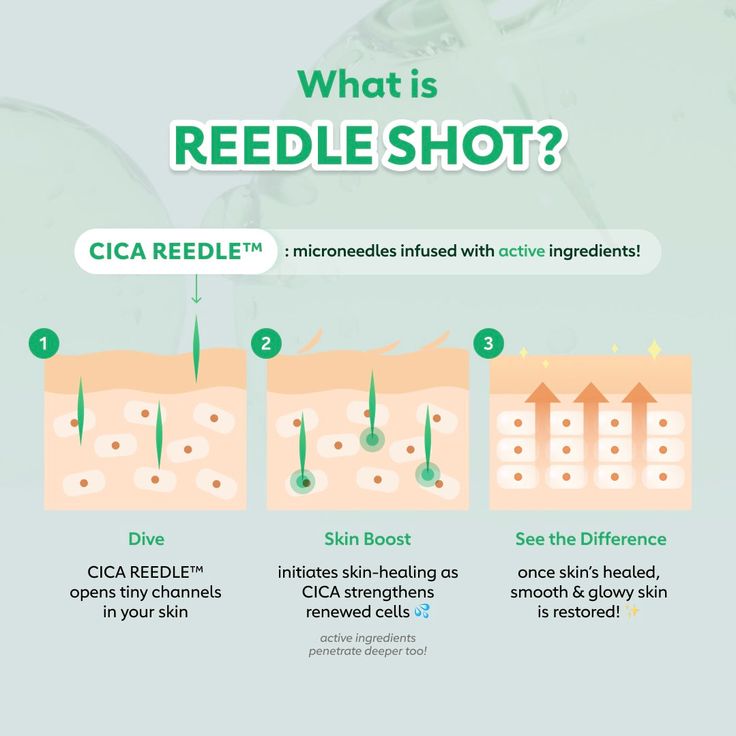 VT - Reedle Shot 100