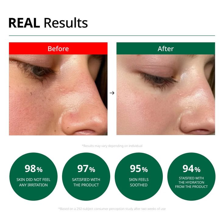 Dr.G - R.E.D Blemish Clear Soothing Cream